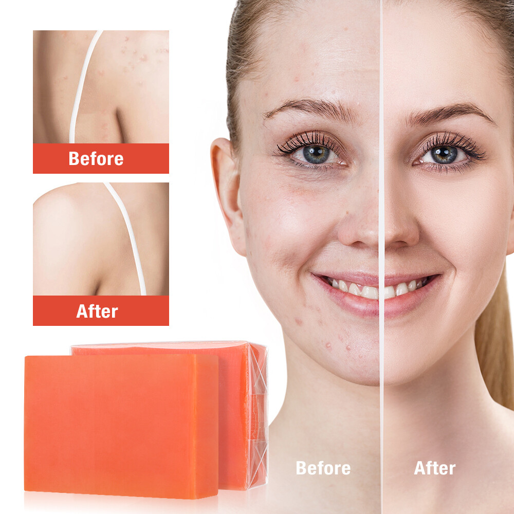 2x Kojic Acid Soap Dark Skin Cleansing Whitening Bleaching Lightening Body Soap