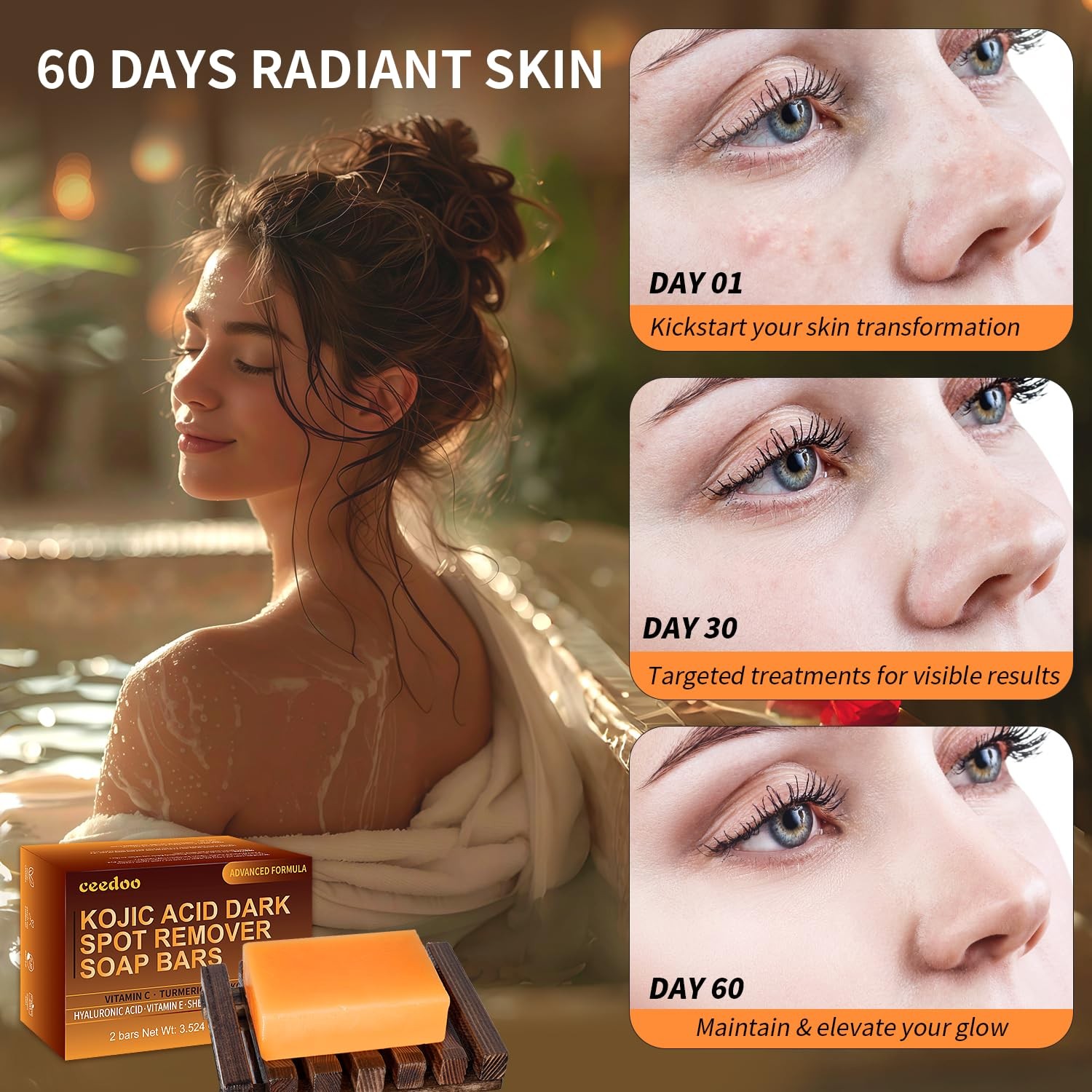 ceedoo Kojic Acid Soap for Dark Spot Remover Bars with 3.5 Ounce (Pack of 2)