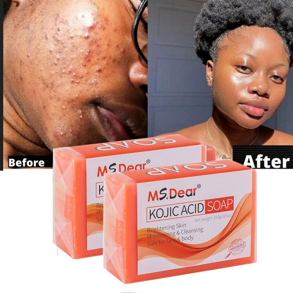 1/2/5 Kojic Acid Dark Spot Remover Skin Lightening Face Whitening Body Bleaching