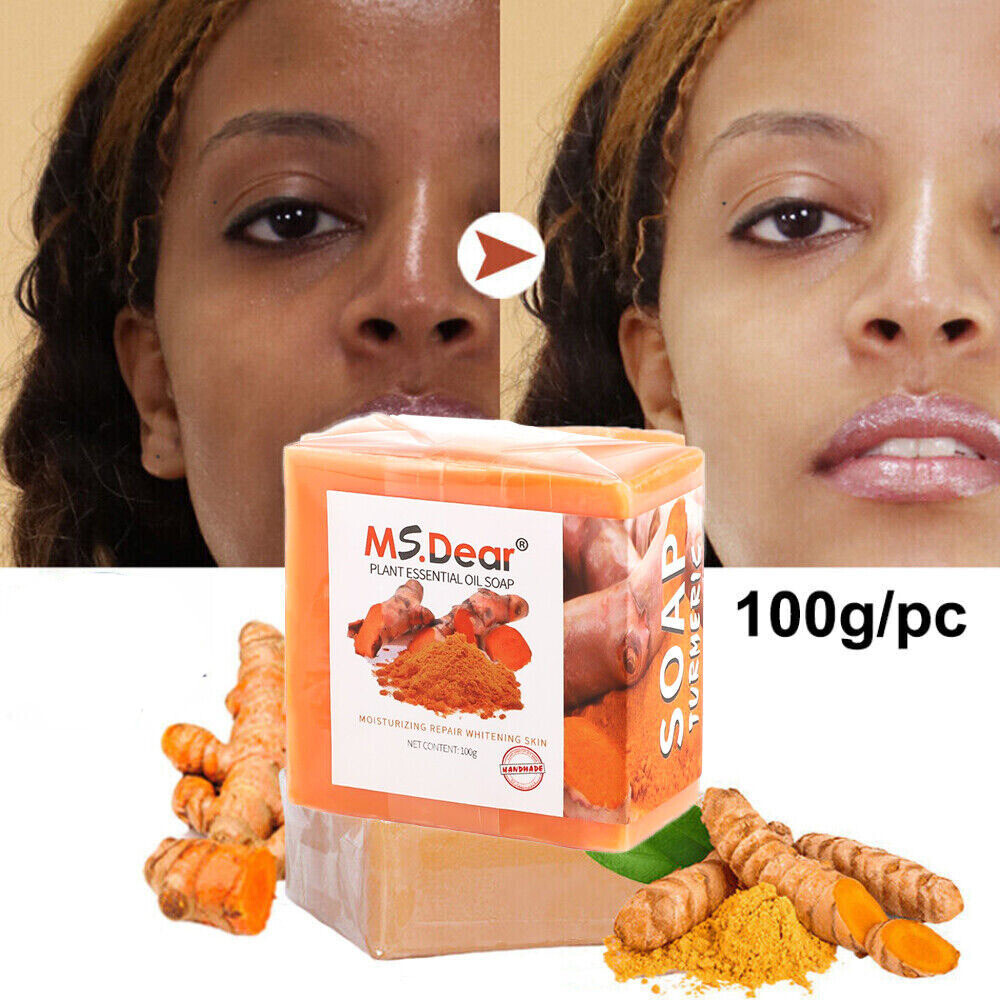 5-1x Tumeric Soap Skin Whitening Dark Spots lightening Acne Brightening Turmeric