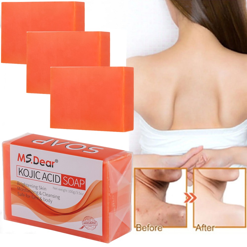 5/3X Kojic Acid Soap Acne Dark Spot Remover Skin Lightening Whitening Face Body