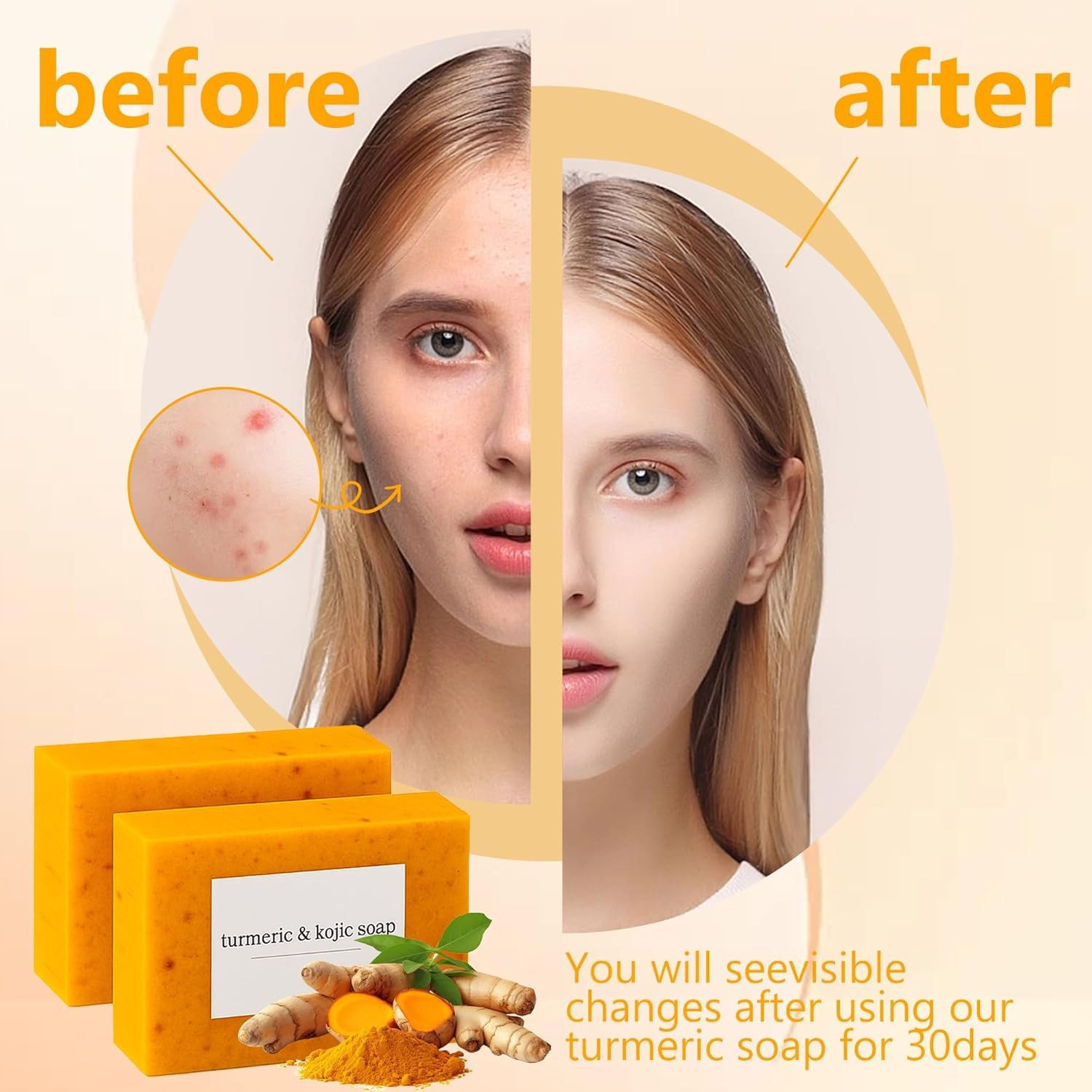3-6PCS Lemon Turmeric Soap,Turmeric Soap Bar for Face&Body,Natural turmeric Hand