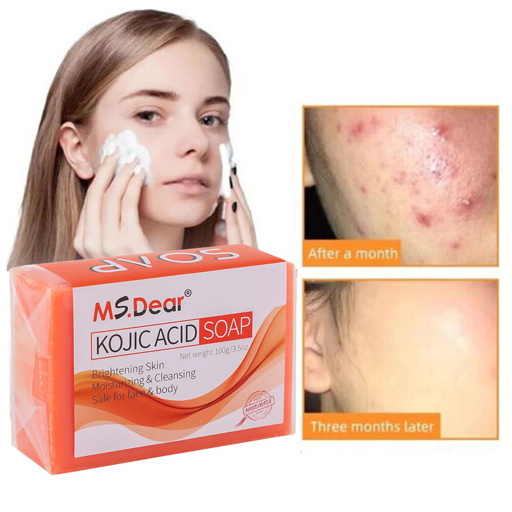 10 Pcs Tumeric Soap, Dark Spots, Skin Glow, Brighter Skin, Scars, All Skin types