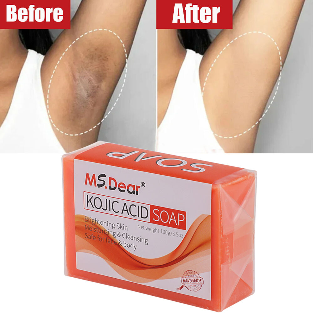5/3X Kojic Acid Soap Acne Dark Spot Remover Skin Lightening Whitening Face Body