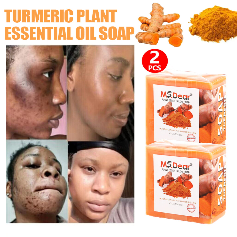 2PCS Tumeric Soap For Dark Spots, Skin Lightening, Anti Acne Cleansing Soap Bar