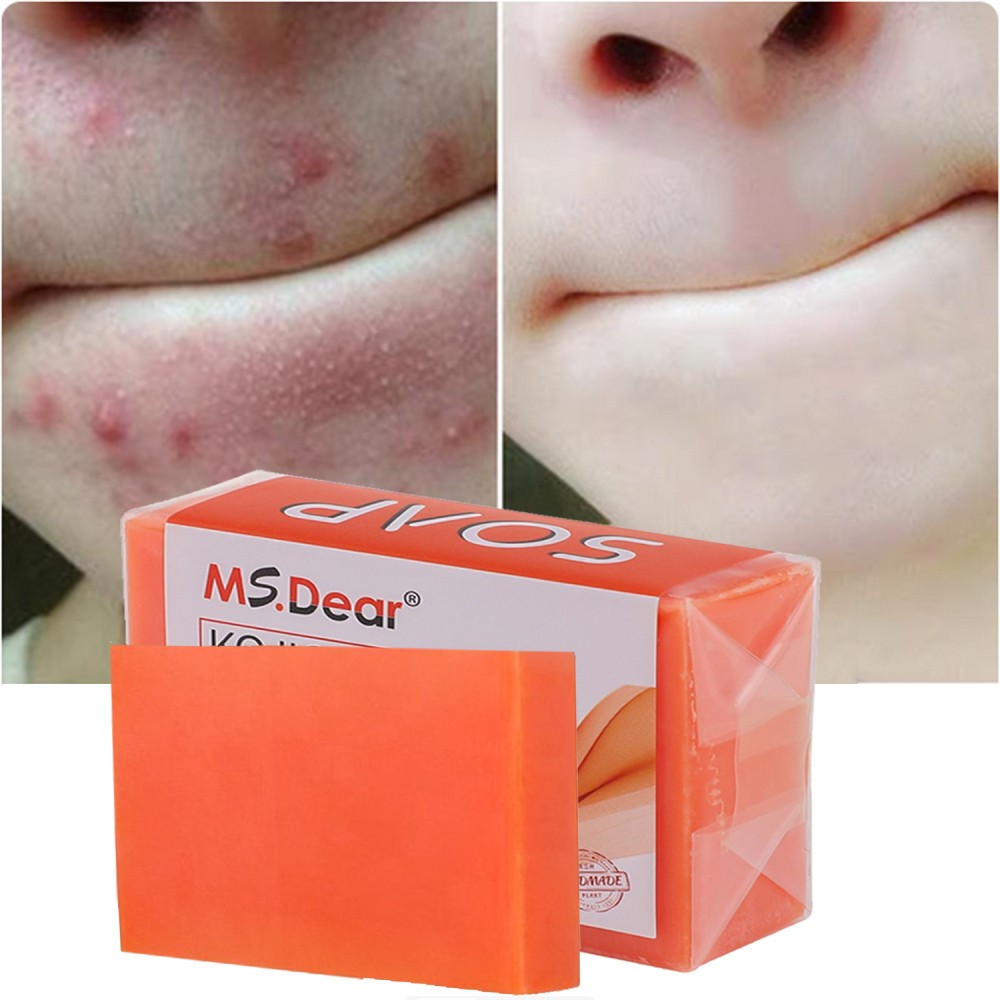 5/3X Kojic Acid Soap Acne Dark Spot Remover Skin Lightening Whitening Face Body