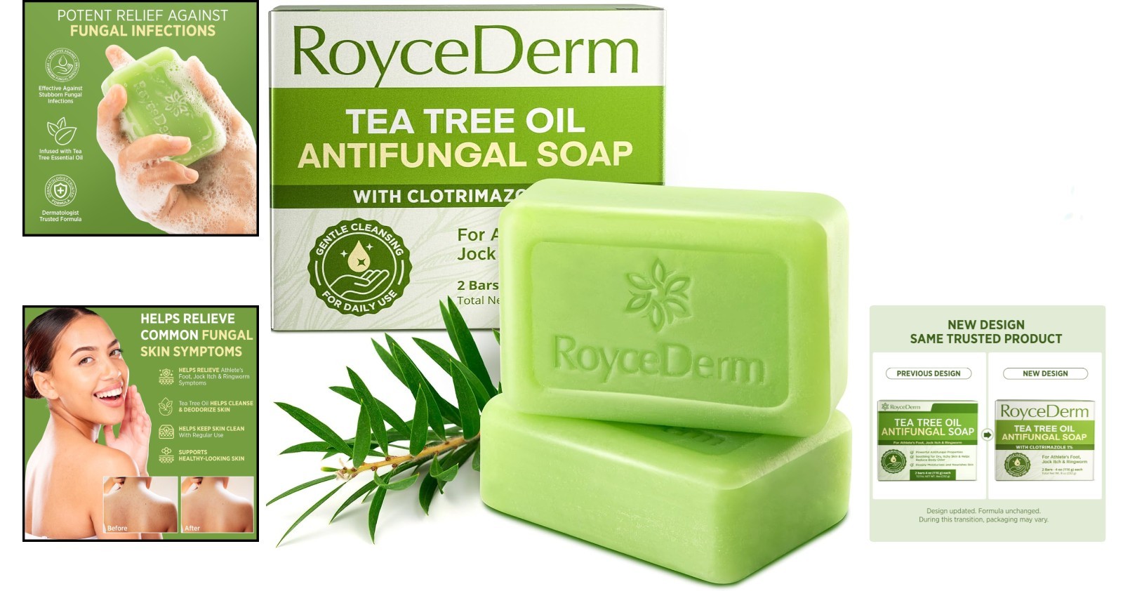 Roycederm Antifungal Antibacterial Tea Tree Soap | Treatment Soap for Face &…